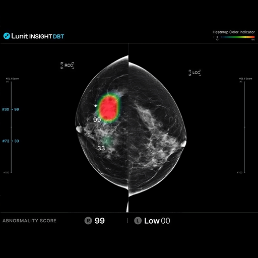 lunit-dbt-image